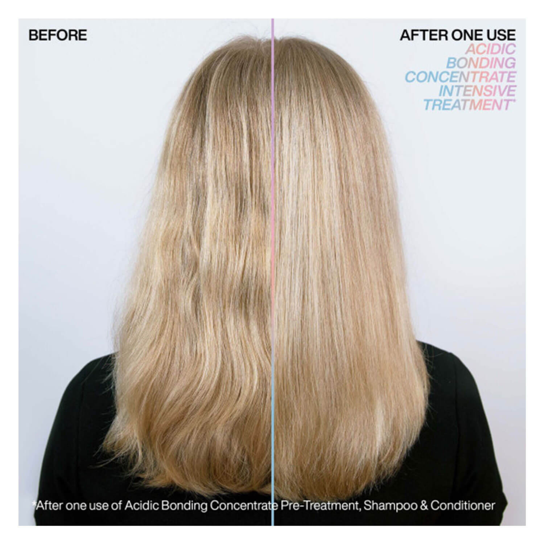 Redken Acidic Bonding Concentrate Intensive Treatment - 150 ml