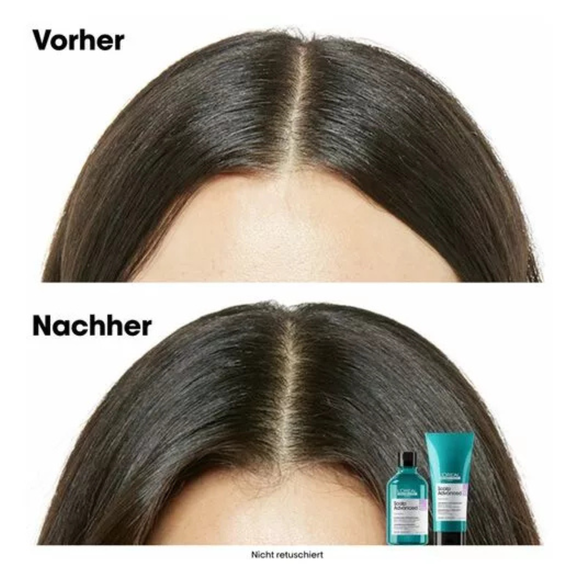 CT-17880_L'Oréal Série Expert Scalp Advanced Anti-Discomfort Dermo-Regulator Nachfüllshampoo