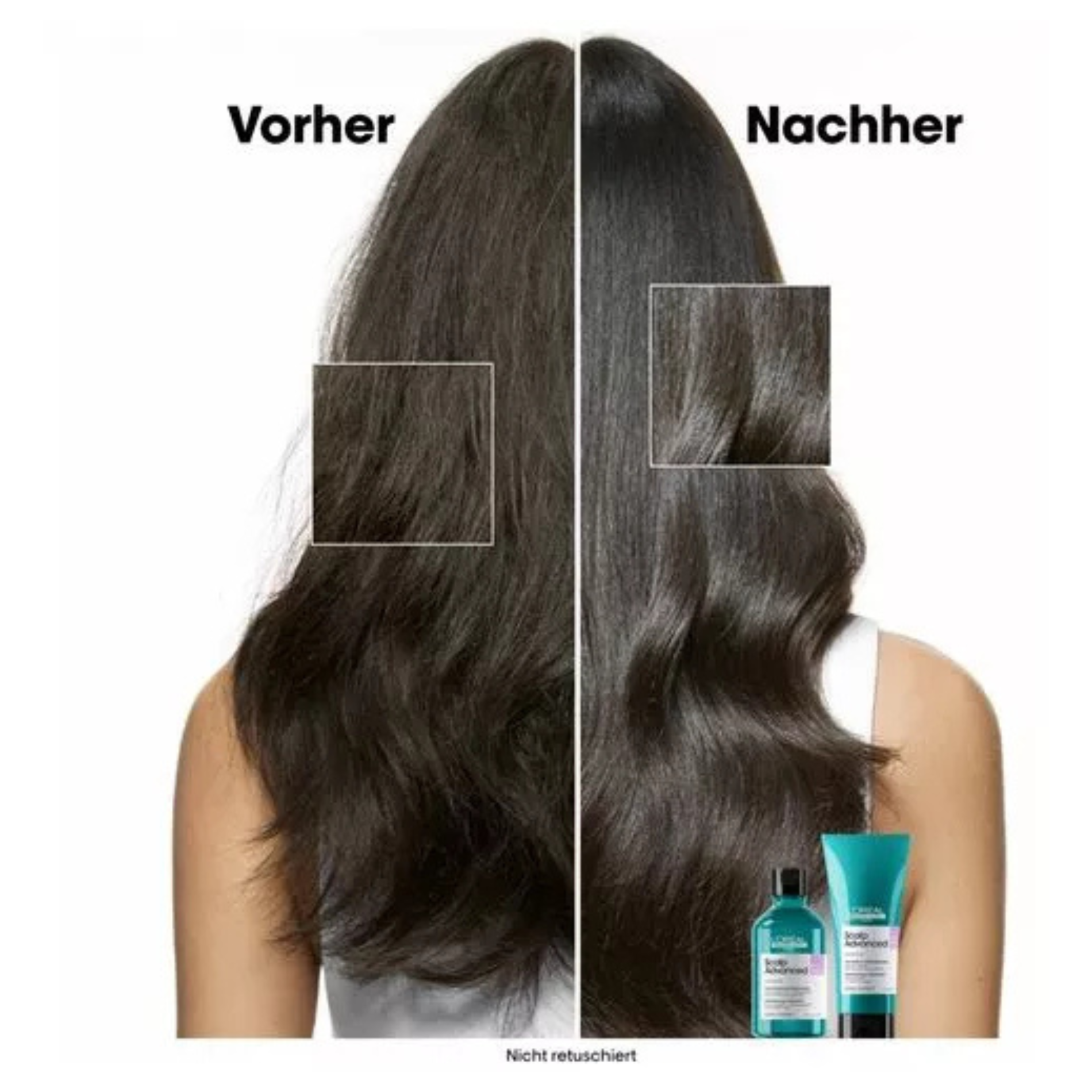 CT-17880_L'Oréal Série Expert Scalp Advanced Anti-Discomfort Dermo-Regulator Nachfüllshampoo